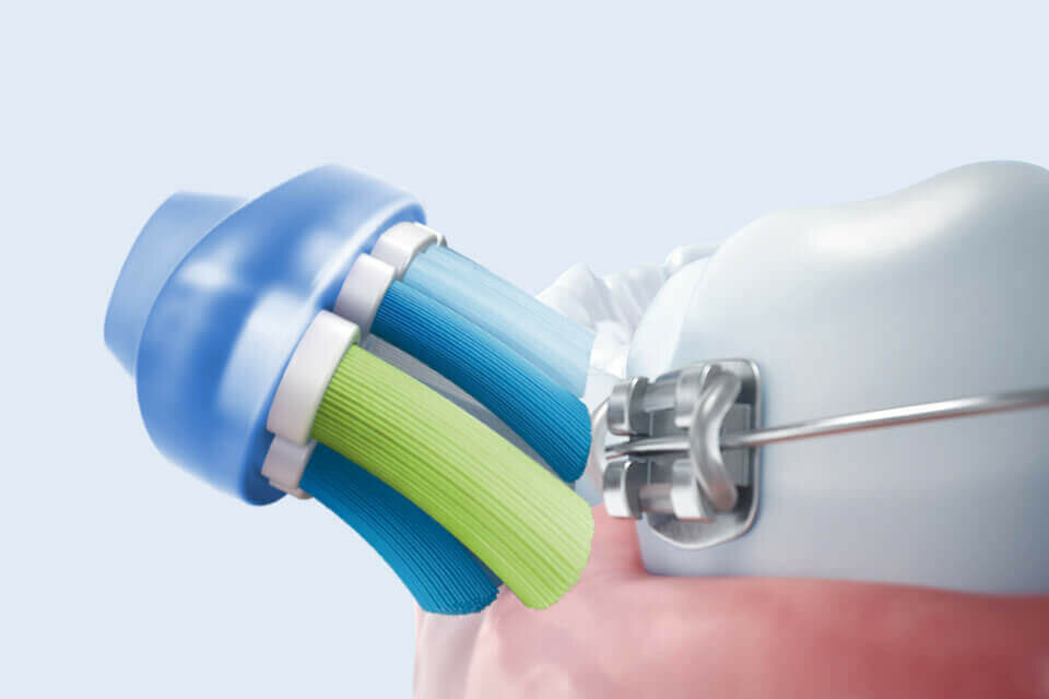 Philips Bezpieczne i delikatne czyszczenie Philips Bezpieczne i delikatne czyszczenie